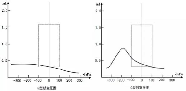 鼓室压图